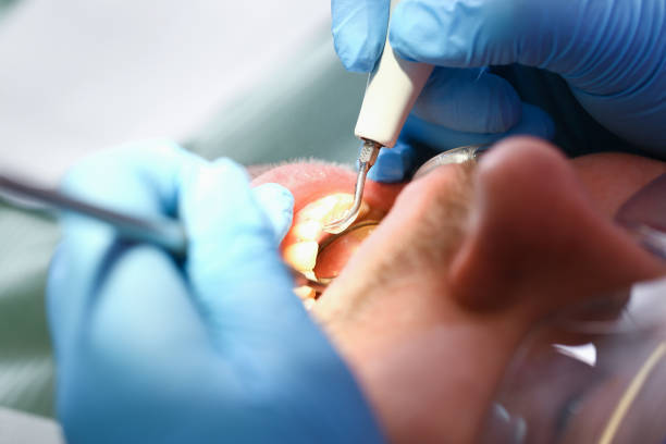 Best Emergency Tooth Extraction  in Mint Hill, NC