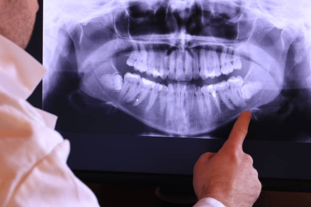 Best Knocked-Out Tooth Emergency  in Mint Hill, NC